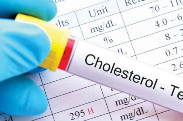أخطرها السكتة الدماغية، مضاعفات وأعراض ارتفاع الكوليسترولالثلاثاء 10/ديسمبر/2024 - 11:25 ص
غالبًا لا تسبب مستويات الكوليسترول المرتفعة أي أعراض، ​​ومع ذلك، يمكن أن تسبب نتوءات جلدية أو تغير لونها في الحالات القصوى.